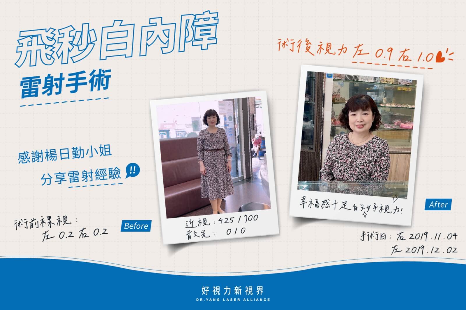 明智選擇，重拾明亮視界！白內障手術的驚人改變！的第2張圖片